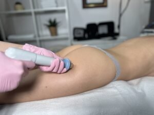 Makale hakkında daha fazla bilgi edinin Антицелулитни терапии: Пътят към по-гладка и стегната кожа
