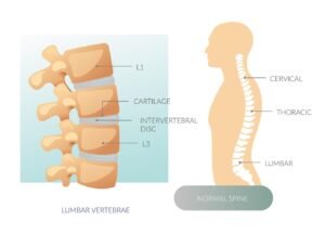 Спондилолистеза 1 анатомия на лумбалния гръбначен стълб