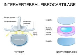 Дискова херния 1 E3TpGi5ijoZJBhSDsfgCRbsac HwhBEwn6Fnye3purGxBGB8q7Y68yuAOEW4eVnuOMnQHQw2awpFjFCjsS I3uF2dYwMo oqXskE93FjIfM - TOPAL Center - Physiotherapy and Chiropractic