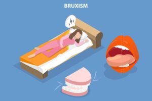 Бруксизъм (Стискане на зъби) 2 Бруксизъм (Стискане на зъби)