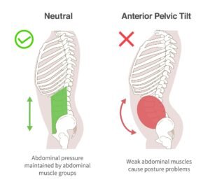 Асиметрия 3 Симптоми на Асиметрия